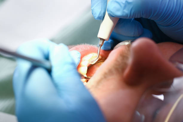 Best Emergency Care for Gum Disease in Manchester, GA