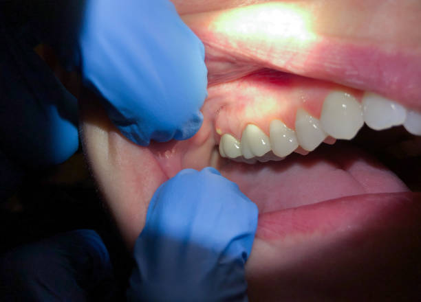 Best Emergency Dental Care for Sports Injuries in Manchester, GA